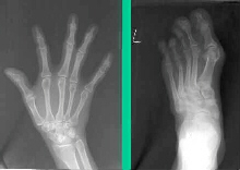 Foot & Hand Radiographs
