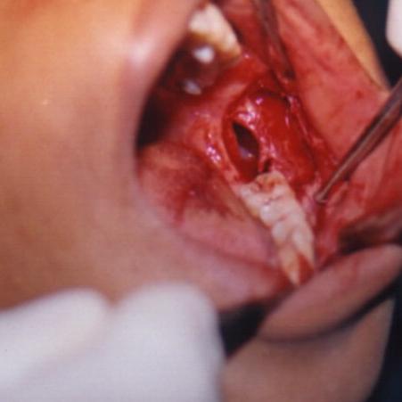 Surgical Picture